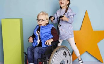 Mengenal Disabilitas Langka Seckel Syndrome dan Terapinya